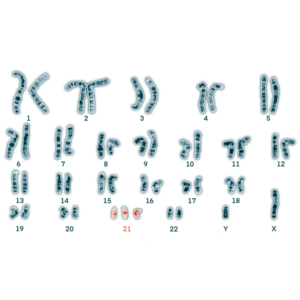 Caryotype T21