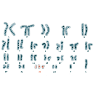 Caryotype T21